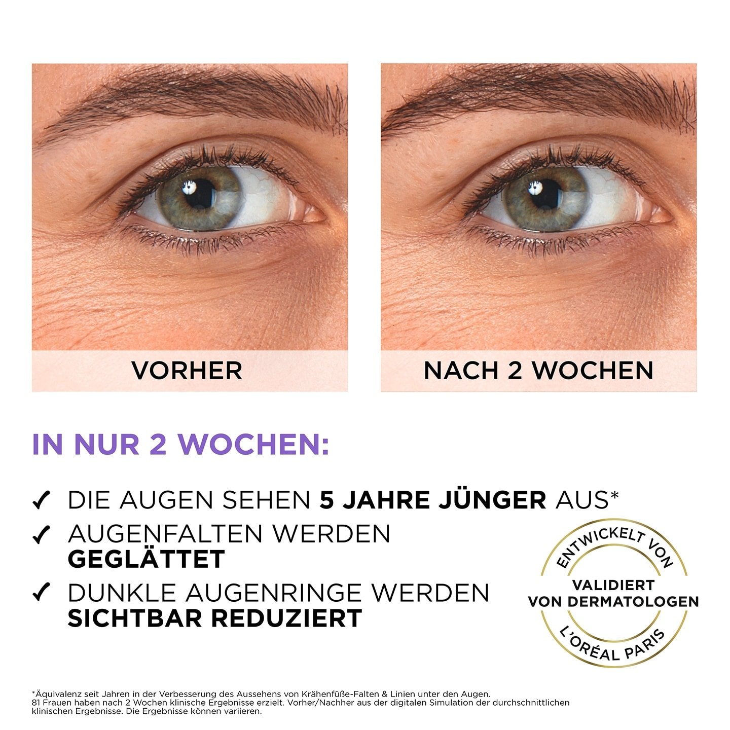 Revitalift Filler Augenserum Vorher/Nachher